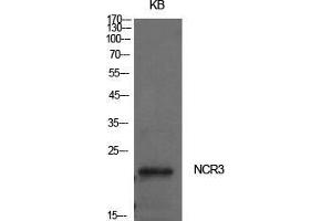 Western Blot (WB) analysis of KB cells using NKp30 Polyclonal Antibody.