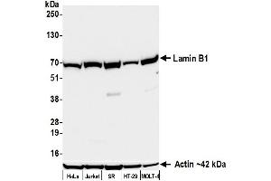 Western Blotting (WB) image for anti-Lamin B1 (LMNB1) (AA 450-500) antibody (ABIN7795810)