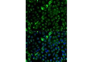 anti-Keratin 17 (KRT17) (AA 133-432) antibody