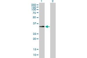 Western Blot analysis of EMD expression in transfected 293T cell line by EMD MaxPab polyclonal antibody. (Emerin anticorps  (AA 1-254))