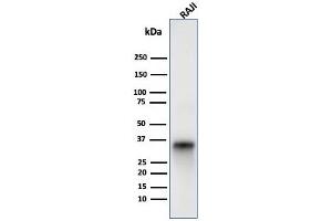 Western blot analysis of Raji cell lysate using CD74 Mouse Monoclonal Antibody (LN-2). (CD74 anticorps)