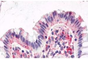 Immunohistochemistry (Formalin/PFA-fixed paraffin-embedded sections) of human colon, surface epithelium with GPR15 polyclonal antibody . (GPR15 anticorps  (1st Cytoplasmic Domain))