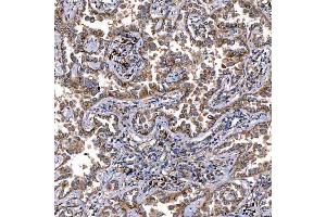 IHC analysis of TTC7B using anti-TTC7B antibody (ABIN7601050). (TTC7B anticorps  (AA 275-730))
