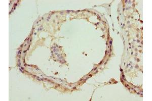 Immunohistochemistry of paraffin-embedded human testis tissue using ABIN7144998 at dilution of 1:100
