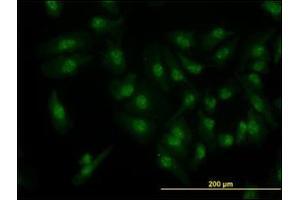 Immunofluorescence (IF) image for anti-Cyclin-Dependent Kinase 6 (CDK6) antibody (ABIN781963)