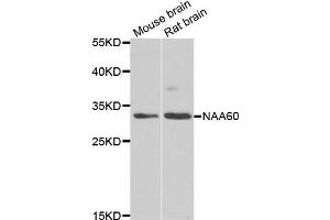 Western blot analysis of extracts of mouse brain and rat brain cell lines, using NAA60 antibody. (NAT15 anticorps)