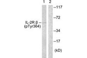 Western blot analysis of extracts from HeLa cells, using IL-2R beta (Phospho-Tyr364) Antibody. (IL2 Receptor beta anticorps  (pTyr364))