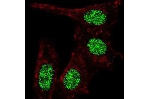 Fluorescent confocal image of HeLa cells stained with KLF4 antibody at 1:100. (KLF4 anticorps  (AA 481-504))