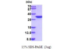 SDS-PAGE (SDS) image for Carbonic Anhydrase XIII (CA13) (AA 1-262) (Active) protein (His tag) (ABIN5854197)