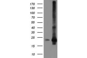 HEK293T cells were transfected with the pCMV6-ENTRY control (Left lane) or pCMV6-ENTRY SAT2 (Right lane) cDNA for 48 hrs and lysed. (SAT2 anticorps)