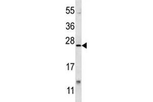 XBP1 antibody western blot analysis in mouse lung tissue lysate.