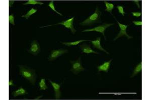 Immunofluorescence of monoclonal antibody to RING1 on HeLa cell.