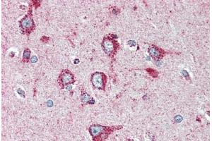 Human Brain, Cortex (formalin-fixed, paraffin-embedded) stained with SOD2 antibody ABIN396955 at 1:50 followed by biotinylated anti-mouse IgG secondary antibody ABIN481714, alkaline phosphatase-streptavidin and chromogen. (SOD2 anticorps)