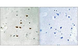 Immunohistochemical analysis of paraffin-embedded human brain tissue using ITCH (Phospho-Tyr420) antibody (left)or the same antibody preincubated with blocking peptide (right). (ITCH anticorps  (pTyr420))