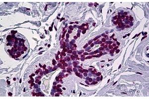 Human Breast: Formalin-Fixed, Paraffin-Embedded (FFPE) (EN1 anticorps  (AA 266-392))