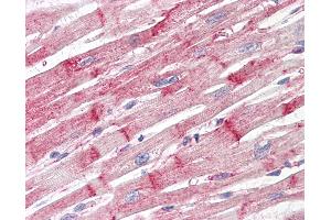 Anti-Nestin antibody IHC of human heart.