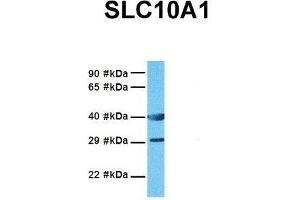 Host:  Rabbit  Target Name:  SLC10A1  Sample Tissue:  Human MDA-MB-435s  Antibody Dilution:  1. (SLC10A1 anticorps  (Middle Region))