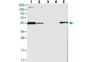 Western blot analysis of Lane 1: RT-4, Lane 2: U-251 MG, Lane 3: Human Plasma, Lane 4: Liver, Lane 5: Tonsil with MFSD11 polyclonal antibody  at 1:250-1:500 dilution. (MFSD11 anticorps)