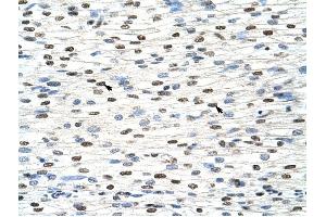 NXF3 antibody was used for immunohistochemistry at a concentration of 4-8 ug/ml to stain Myocardial cells (arrows) in Human Heart. (NXF3 anticorps  (C-Term))