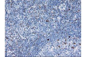 Image no. 4 for anti-Signal Transducer and Activator of Transcription 4 (STAT4) antibody (ABIN1501180)
