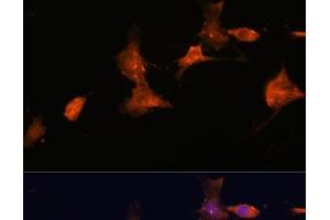 Immunofluorescence analysis of C6 cells using TSC2 Polyclonal Antibody at dilution of 1:100. (Tuberin anticorps)