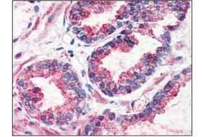 Immunohistochemistry: GPR126 antibody staining of Formalin-Fixed, Paraffin-Embedded Human Prostate. (G Protein-Coupled Receptor 126 anticorps  (N-Term))