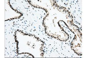 Immunohistochemical staining of paraffin-embedded Human Kidney tissue using anti-USP5 mouse monoclonal antibody. (USP5 anticorps)