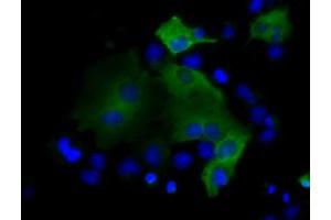 Image no. 7 for anti-Proteasome (Prosome, Macropain) 26S Subunit, ATPase, 3 (PSMC3) antibody (ABIN1501331) (PSMC3 anticorps)