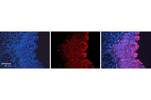 Rabbit Anti-SHH Antibody   Formalin Fixed Paraffin Embedded Tissue: Human Urinary Bladder Tissue Observed Staining: Plasma membrane, Cytoplasm Primary Antibody Concentration: 1:100 Other Working Concentrations: N/A Secondary Antibody: Donkey anti-Rabbit-Cy3 Secondary Antibody Concentration: 1:200 Magnification: 20X Exposure Time: 0.