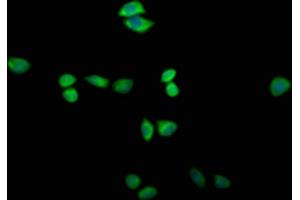 Immunofluorescence staining of Hela cells with ABIN7171907 at 1:200, counter-stained with DAPI. (TTC14 anticorps  (AA 569-770))