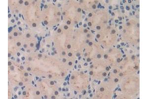 Detection of MIP1b in Mouse Kidney Tissue using Polyclonal Antibody to Macrophage Inflammatory Protein 1 Beta (MIP1b) (CCL4 anticorps  (AA 24-92))