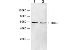 Western blot analysis of cell lysate using 1 µg/mL Rabbit Anti-Chk1 (Ser280) Polyclonal Antibody (ABIN398709) Lane 1: Hela cell lysateLane 2: HEK293 cell lysateThe signal was developed with IRDyeTM 800 Conjugated Goat Anti-Rabbit IgG. (CHEK1 anticorps  (Ser280))