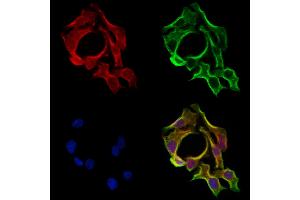 ABIN6265129 and ABIN6273163 staining Hela cells by IF/ICC. (SLC38A3 anticorps  (Internal Region))