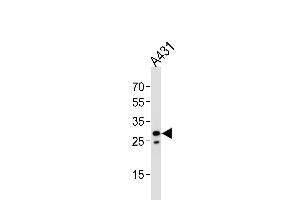 Western blot analysis of lysate from A431 cell line, using RN Antibody (Center) (ABIN651929 and ABIN2840458). (RNF208 anticorps  (AA 86-115))