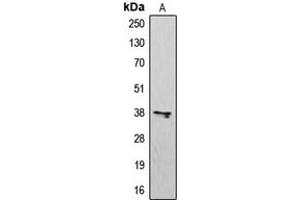 Western blot analysis of CD183 expression in K562 (A) whole cell lysates. (CXCR3 anticorps  (Center))