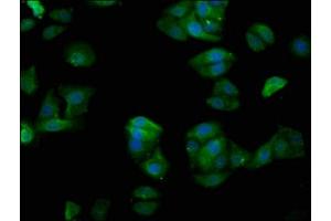 Immunofluorescence staining of HepG2 cells with ABIN7153569 at 1:200, counter-stained with DAPI. (TUBGCP4 anticorps  (AA 203-309))