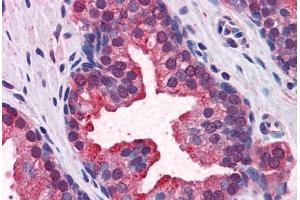 Human Prostate: Formalin-Fixed, Paraffin-Embedded (FFPE)