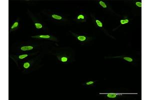 Immunofluorescence of purified MaxPab antibody to SSB on HeLa cell.