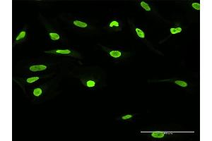 Immunofluorescence of purified MaxPab antibody to SSB on HeLa cell. (SSB anticorps  (AA 1-408))