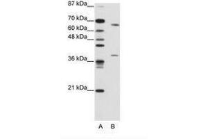 Image no. 2 for anti-Grainyhead-Like 3 (GRHL3) (AA 529-578) antibody (ABIN203223) (GRHL3 anticorps  (AA 529-578))