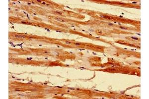 Immunohistochemistry of paraffin-embedded human heart tissue using ABIN7142451 at dilution of 1:100 (MRPL55 anticorps  (AA 34-128))