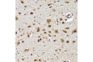 Immunohistochemistry of paraffin-embedded rat brain using UBQLN4 Rabbit pAb (ABIN7271124) at dilution of 1:150 (40x lens).