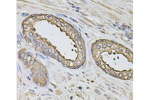 Immunohistochemistry of paraffin-embedded Human prostate using S100A12 Polyclonal Antibody at dilution of 1:100 (40x lens). (S100A12 anticorps)