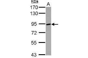 WB Image Sample (30 ug of whole cell lysate) A: Raji 7. (ADAM8 anticorps  (C-Term))