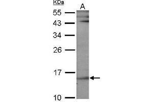WB Image Sample (30 ug of whole cell lysate) A: NIH-3T3 12% SDS PAGE antibody diluted at 1:1000 (UBE2B anticorps)