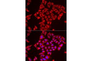 Immunofluorescence analysis of HeLa cell using ST3GAL3 antibody. (ST3GAL3 anticorps)