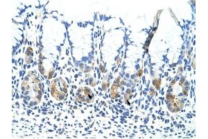 ADAT1 antibody was used for immunohistochemistry at a concentration of 4-8 ug/ml to stain Epithelial cells of fundic gland (arrows) in Human Stomach.
