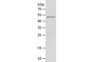 Western Blotting (WB) image for Transcription Factor 4 (TCF4) (AA 1-507) protein (His tag) (ABIN7125439)