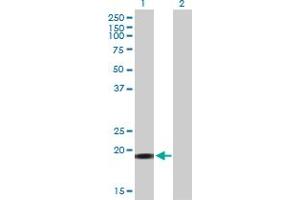 Western Blot analysis of YSK4 expression in transfected 293T cell line by YSK4 MaxPab polyclonal antibody. (MAP3K19 anticorps  (AA 1-168))
