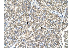 Immunohistochemistry (IHC) image for anti-ATPase, Na+/K+ Transporting, beta 1 Polypeptide (ATP1B1) (Middle Region) antibody (ABIN2781852)
